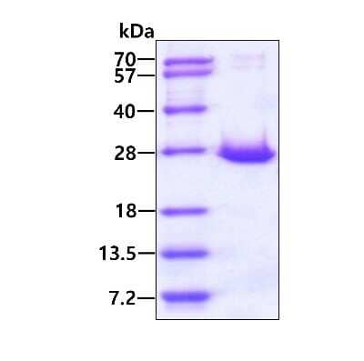 SDS-PAGE: Recombinant Human ARL14 His Protein [NBP1-72461]